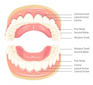 Teeth extraction