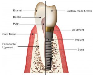 Dental prosthesis in Sumy city