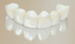 протезирование зубов в сумах