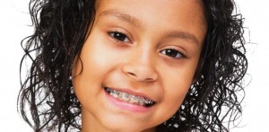 Вирівнювання зубів у дітей
