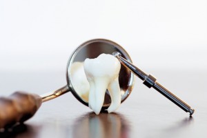 Техника удаления зубов