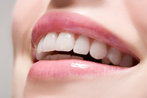 Что такое фотоотбеливание зубов