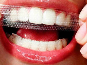 Отбеливающие плоски для зубов