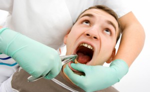 Осложнения после удаления зуба