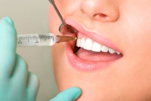 анестезия стоматология