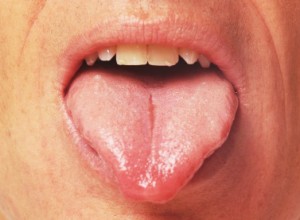 Диагностика заболеваний по языку