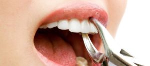 Хирургическая стоматология в городе Сумы