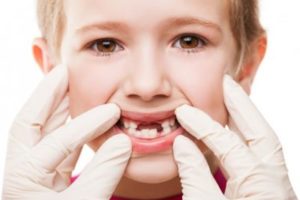5 важных фактов о детских зубах