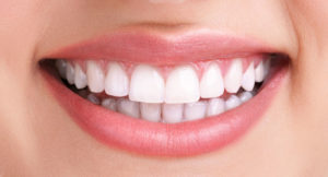 Негативные последствия имплантации зубов