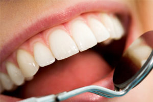 Кариес и степени поражения зуба